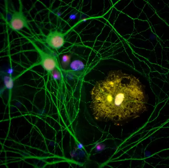 AC Immune Therapeutic approach cell culture | Pioneering Precision Medicine for neurodegenerative diseases
