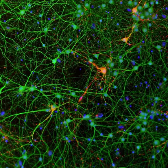 AC Immune Technology Platforms Immunostained a-syn aggregates | Pioneering Precision Medicine for neurodegenerative diseases